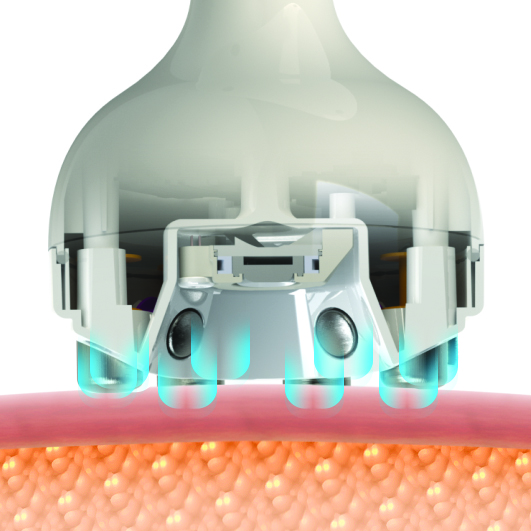 Venus Legacy Magnetic Field How PEMF works