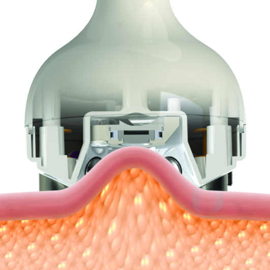 Venus Legacy Vakum How vacuum works