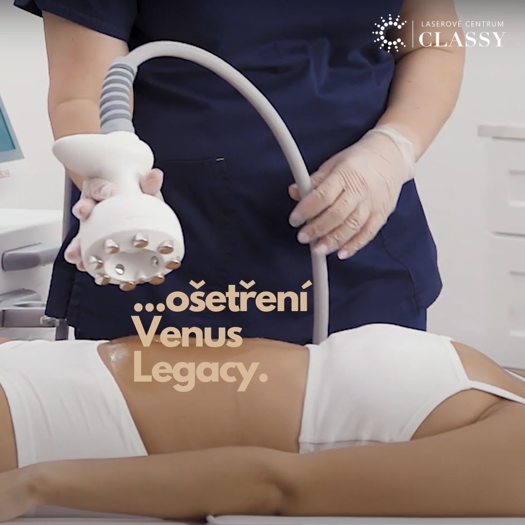 Laser hair removal treatment how it looks